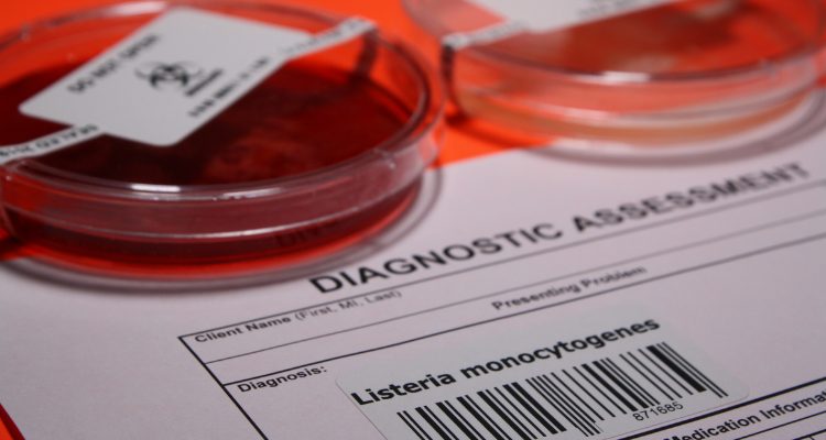 Listeria monocytogenes: dal 1° luglio 2026 cambia il criterio di sicurezza alimentare in UE